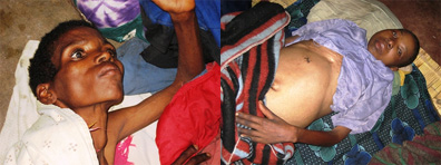 Chapter4：インターナショナル・エイズ・デーに寄せて