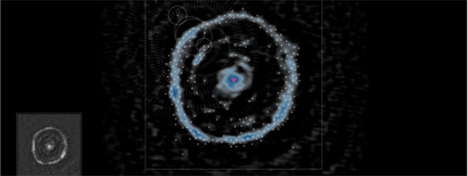 ART｜超高性能電波望遠鏡「アルマ望遠鏡」データでコンテンツを制作
