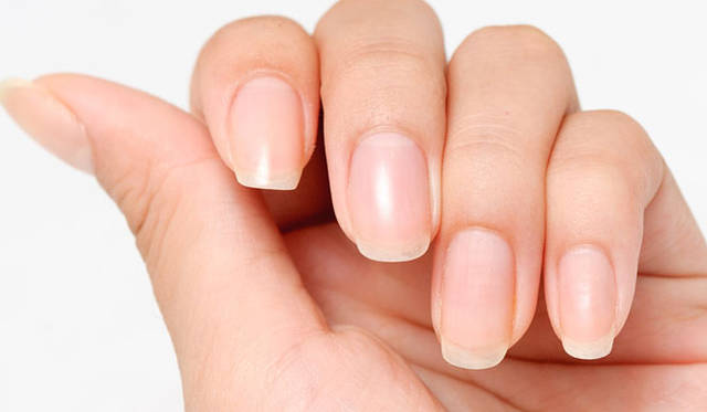 <strong> KOBAKO｜KOBAKO nails </strong>　ケア後には、すっきり明るく血色のいい“素爪”が誕生！