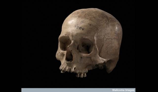 <strong>ART FILE 06｜「DEATH: A self-Portrait」</strong>　Incan skull, 16th century Credit:The Richard Harris Collection