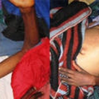 Chapter4：インターナショナル・エイズ・デーに寄せて