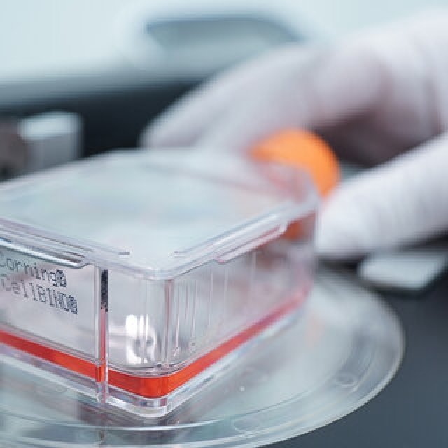 日本で初めて受理された治療法。「不妊症に対する自家月経血由来幹細胞」｜LOUNGE