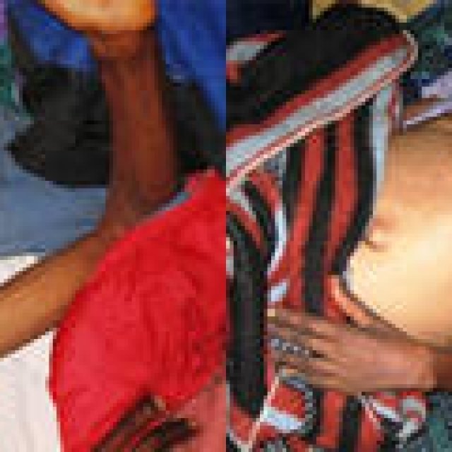 Chapter4：インターナショナル・エイズ・デーに寄せて