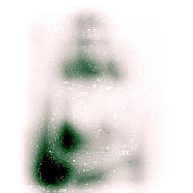 Diary-T 75　My Girl