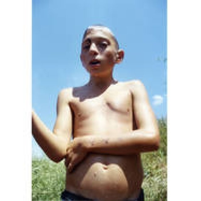  RAT HOLE GALLERY｜綿谷 修新作展「Juvenile」 ギャラリー